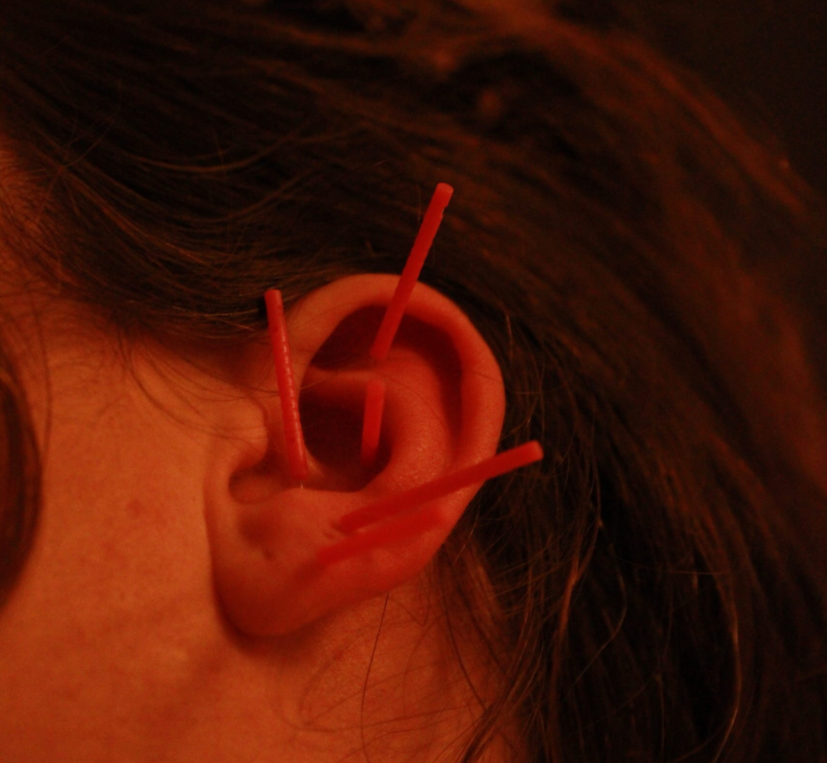 oreille auriculothéraphie